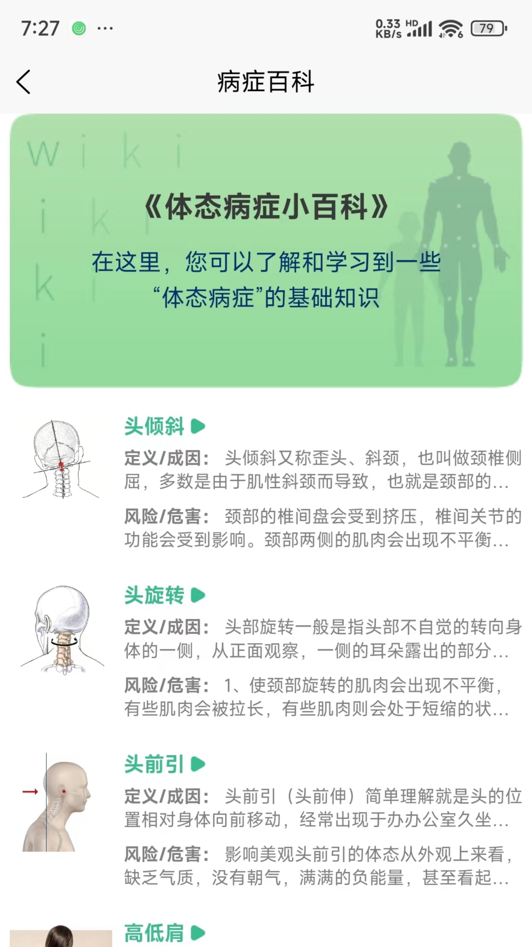 BodyLang体态评估